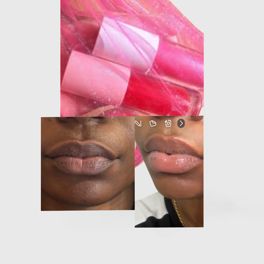 Kit lèvre rose éclaircissant